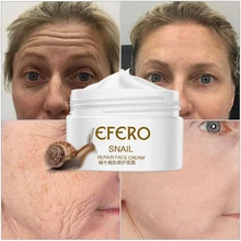 30g Acne Snail Whitening Face Cream Serum for Face Anti-wrinkle Snail Cream Aloe Vera Skin Whitening Cream Moisturizer 30g Acne Snail Whitening Face Cream Serum for Face Anti-wrinkle Snail Cream Aloe Vera Skin Whitening Cream Moisturizer