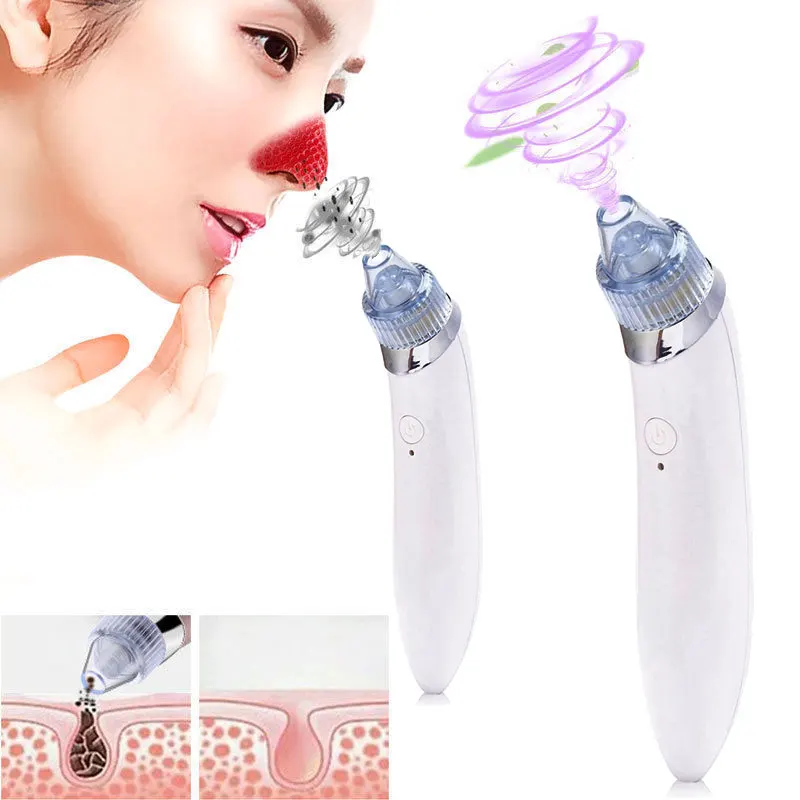 

Beauty Black Head Cleaner Blackhead Removal Equipment Fashion White Clean ABS Fast Remove Cosmetic Instrument