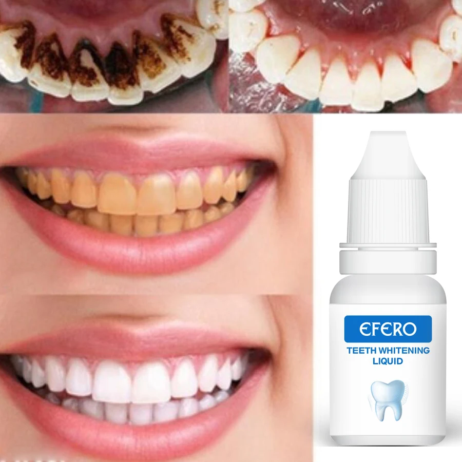 EFERO эффективное отбеливание зубов эссенция белых зубов Стоматологическая гигиена полости рта Удаляет налет пятна отбеливания зубов Чистящая сыворотка