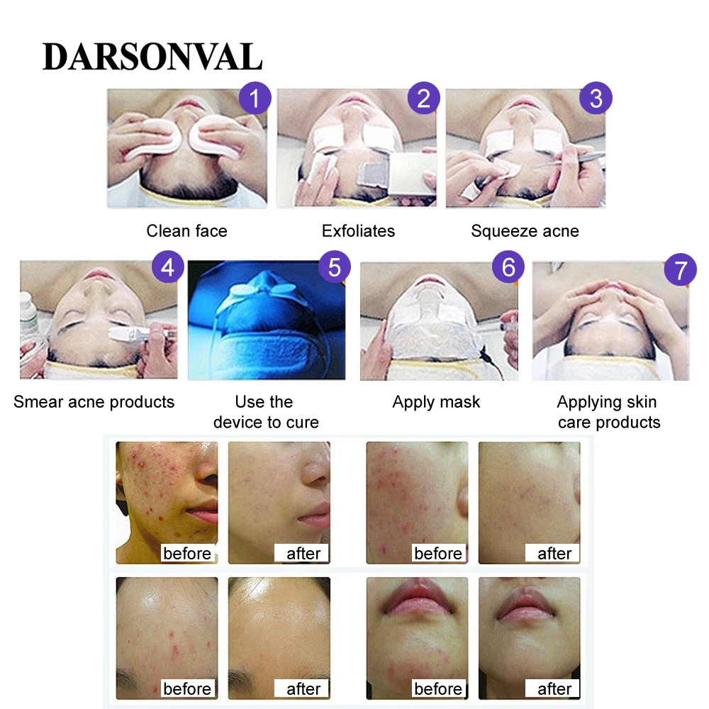  7 Color PDT Photon LED Mask Facial Light Anti Aging Machine Therapy Skin Rejuvenation Acne Remover  - 33019727296