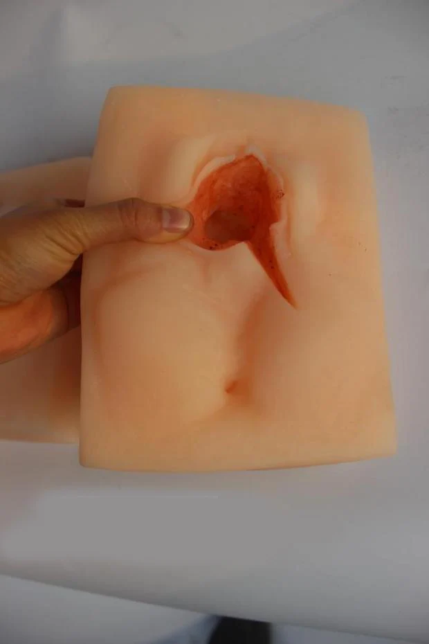Episiotomy Suture Practice Set 2