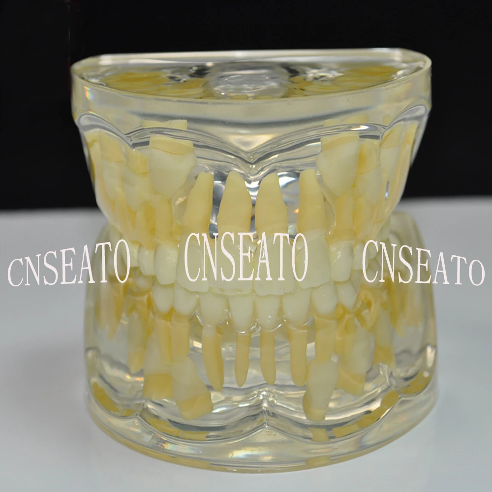 

1 pc Dental Model for Permanent teeth 7-9Years Demonstration Clear Model with Teaching and Science Teeth Whitening