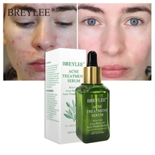 BREYLEE Tea Tree Acne Treatment Serum Essence Facial Anti Acne Scar Removal Cream Repair Pimple Remover Whitening Face Skin Care