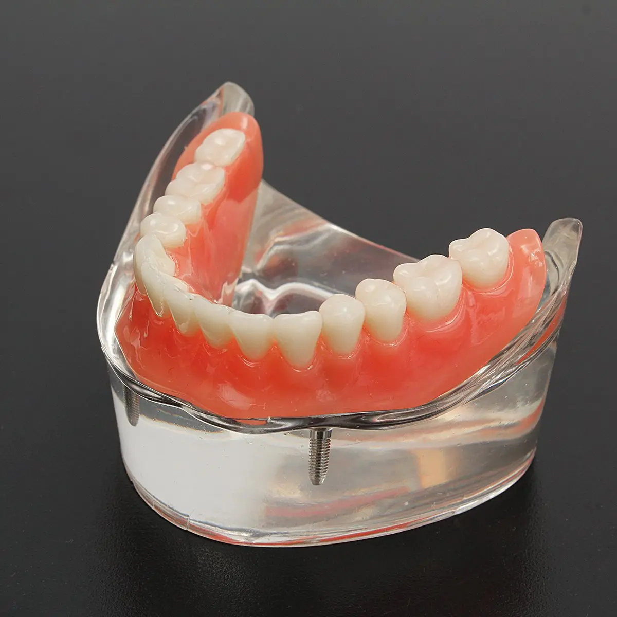 Dental Overdenture Interior Mandibular Lower Teeth Model Mandibular With Implant Restoration Tooth Medical Dental Teaching Study цена Dental Overdenture Interior Mandibular Lower Teeth Model Mandibular With Implant Restoration Tooth Medical Dental Teaching Study цены онлайн