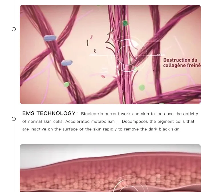 BB Eyes ems зажим для массажа глаз для лица Вибрация для удаления морщин тонкая волшебная палочка для лица анти мешок и морщинки для ухода за кожей глаз инструменты