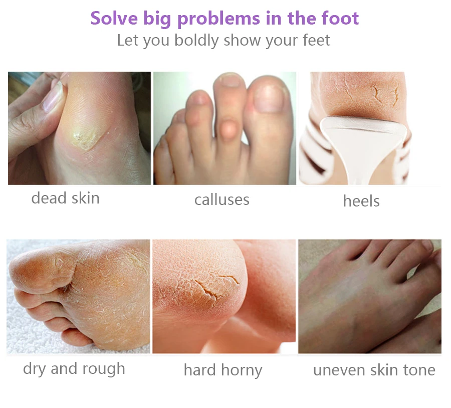 4Pcs=2pack Exfoliating Foot Mask Pedicure Socks Exfoliation for Feet Mask for Leg Remove Dead Skin Peeling Lavender Foot Masks 4Pcs=2pack Exfoliating Foot Mask Pedicure Socks Exfoliation for Feet Mask for Leg Remove Dead Skin Peeling Lavender Foot Masks