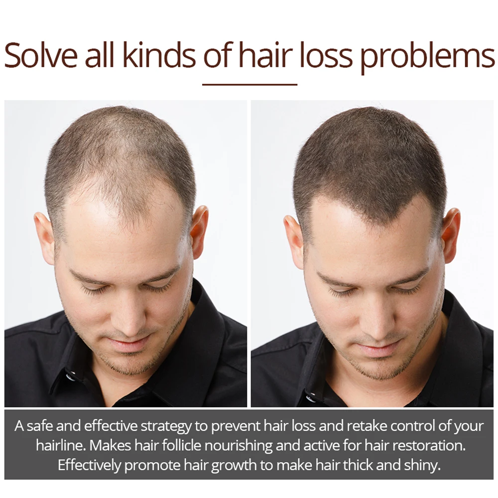 Яркие гламур жидкость для роста волос питают корни толстые и блестящие от