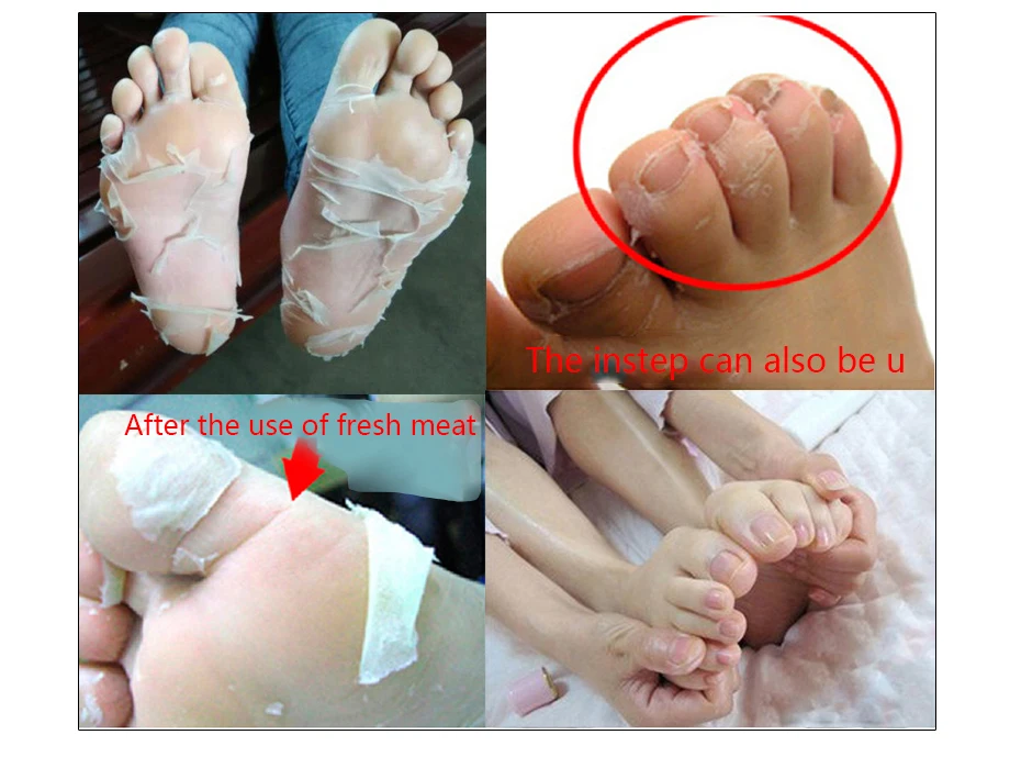 Efero 2 шт = 1 пара алоэ пилинг маска для ног отшелушивающие носки для педикюра против трещин пятки удаление кожи патч для ног