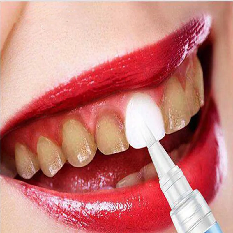 

Dental Teeth Whitening Pen Gel Strips Bleach Stain Remover Tooth Gel Instant Whitener Dental Bleaching Teeth care Skin Care