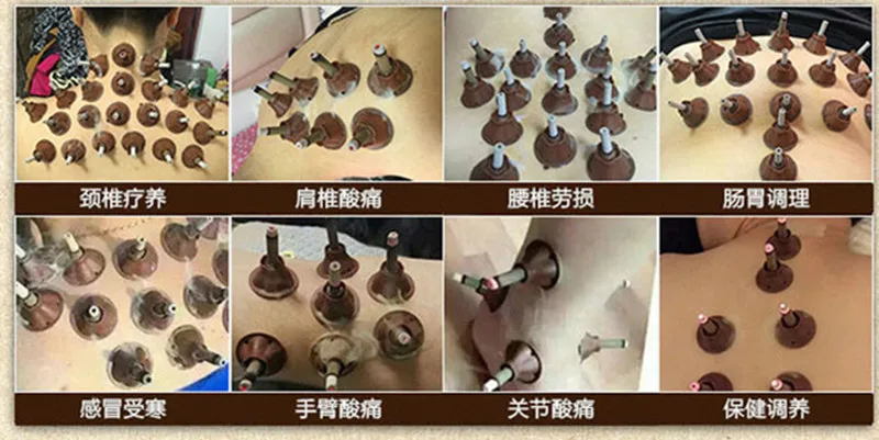 50pcs-lot-Moxa-Sticker-meridian-acupuncture-moxibustion-moxa-stick-moxibustion-body-micro-smoke-tube (5)