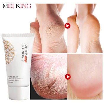 

MEIKING Baby Foot Care Deep Exfoliation for Feet peel Anti Drying Remove Dead Skin Foot Lotion Exfoliating Cream foot mask 80g