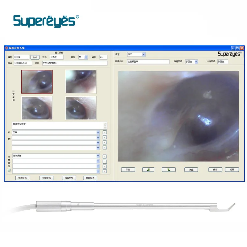 Supereyes Y003 Беспроводной WI-FI 1-500x визуальный уха Палочки эндоскоп Отоскоп
