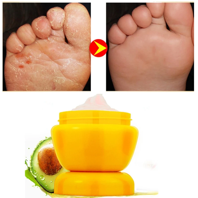 foot clear cream