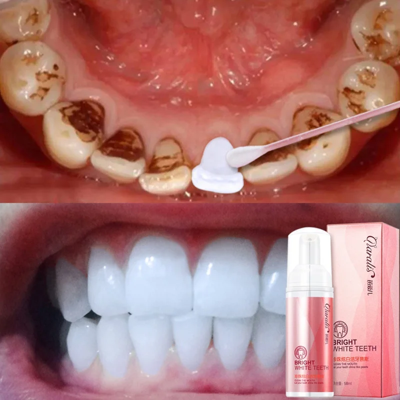 

Quickly Remove Smoke Teeth Black Teeth Oral Cleanser Teeth Whitening Product 58 ml Toothache Treatment Mouth Spray Moisturizer