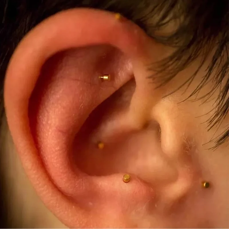 100pcsQizhouearacupunctureneedlegoldensilverearpinearpoint