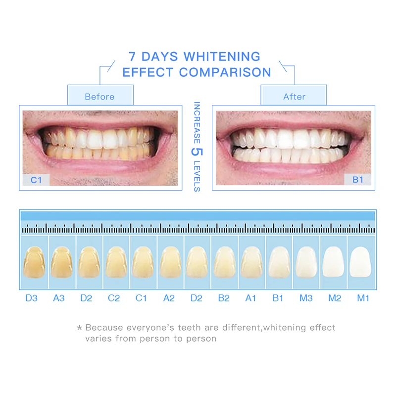 UCANBE отбеливающая ручка для отбеливания зубов, гель для чистки зубов, набор для удаления пятен, яркий 3D отбеливатель для зубов, уход за зубами, 1 шт