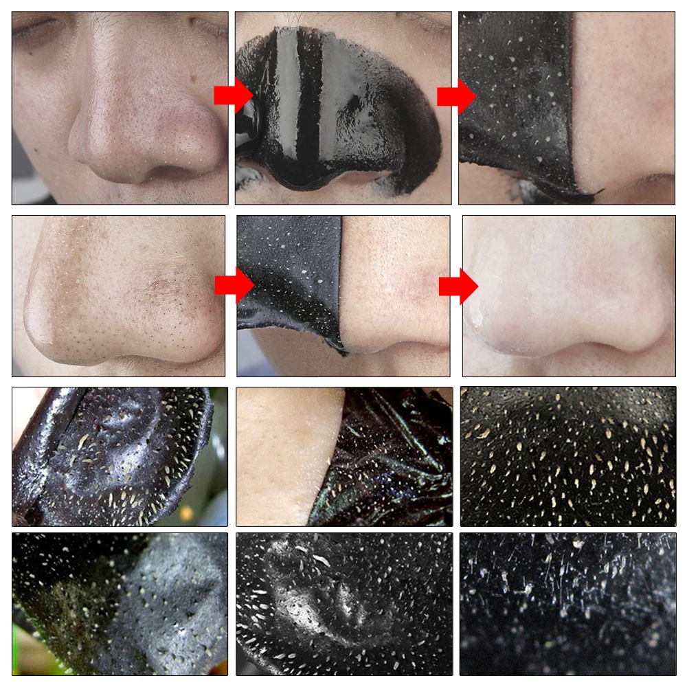 Домашняя маска от черных точек на носу