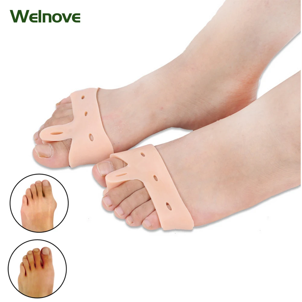 Ортез на 1 палец стопы при hallux valgus. Ортез valguloc. Ортез на пальцы стопы. Ортез на пальцы стопы. Ортопедические приспособления для стопы.