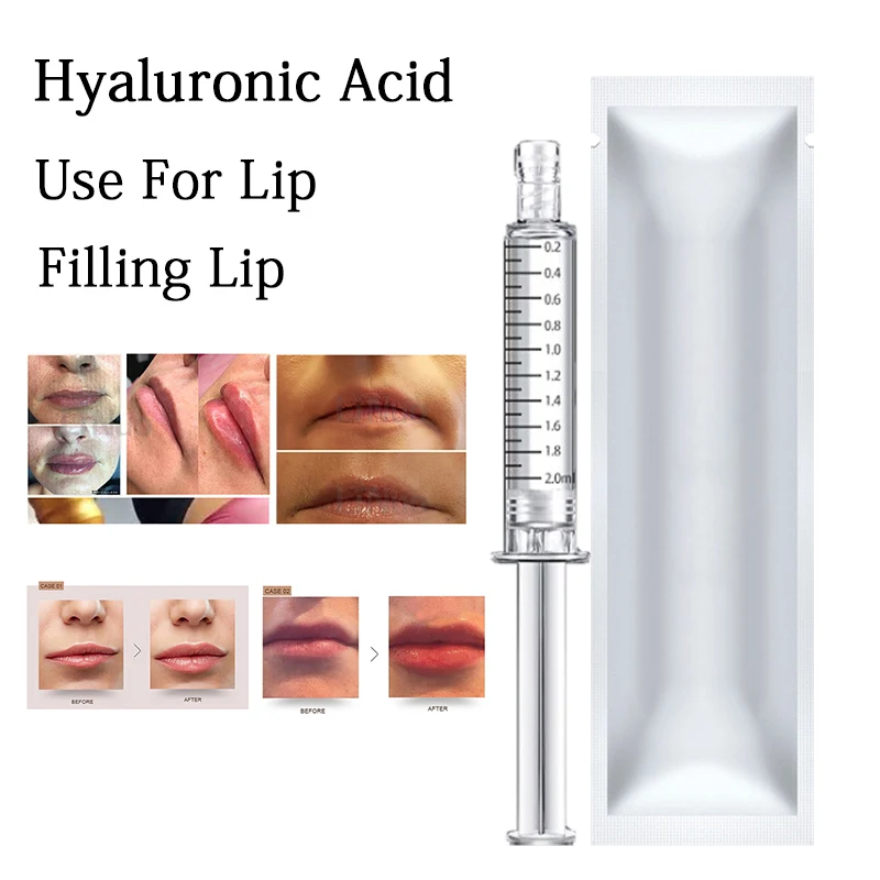 

2ml Hyaluronic acid injectable filling lips for atomizer hyaluronic pen atomizer injection gun lip filling Anti Wrinkle bo tox