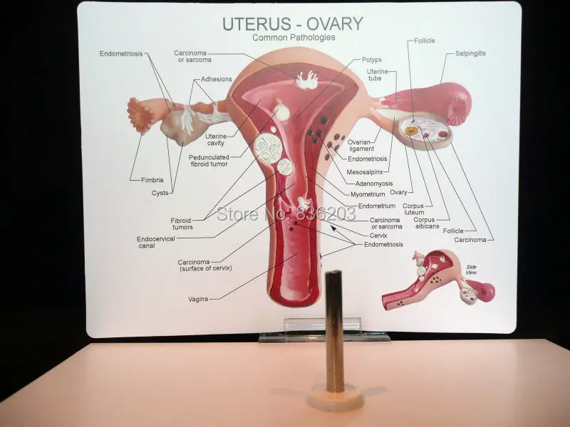 Патологическая матка и яичник анатомическая модель в травме анатомический Скелет стоматологический анатомический теневой медицинский тренировочный манекен