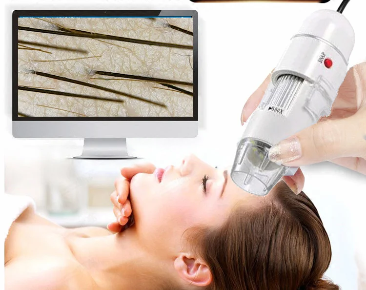 Skin Tester Scalp Detector Hair Folding Detector Usb Connect Computer