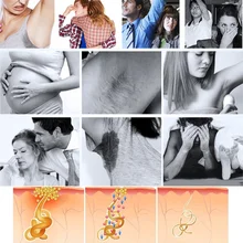 Подмышек Hircismus спрей-очиститель антиперспирант дезодорант спрей для тела удаление запаха тела