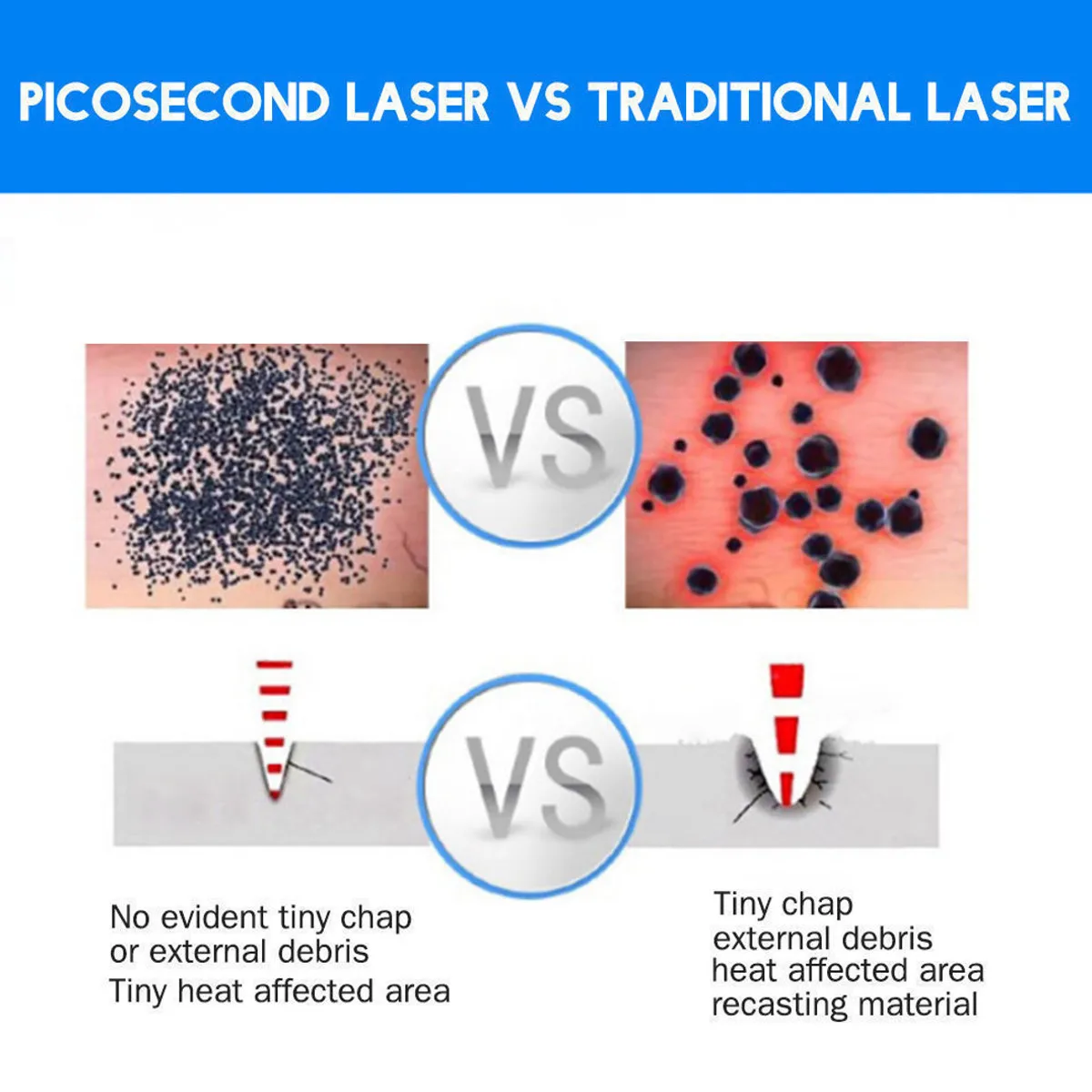 Scar Tattoo Removal Laser Pen Freckle Acne Mole Dark Spot Pigment Tattoo Removal Beauty Machine Pro Repair Picosecond Pen