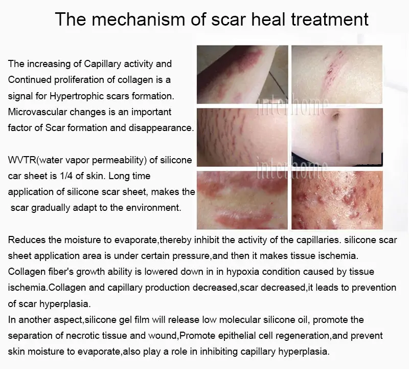 Медицинский силиконовый гель шрам от листа терапевтическая рана; шрам патч удаляемая чесаная область раздел гипертрофическая Sca келиоидная повторная обработка