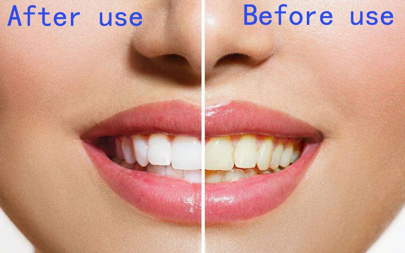 HTB1I2avAgKTBuNkSne1q6yJoXXax