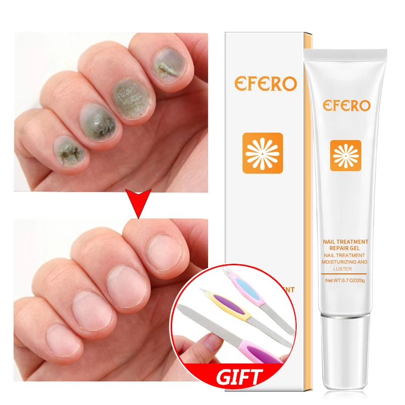 

efero Nail Repair Product Anti Fungal Remove Onychomycosis Nail Whitening Professional Nails Care Whitening Cuticle Removal