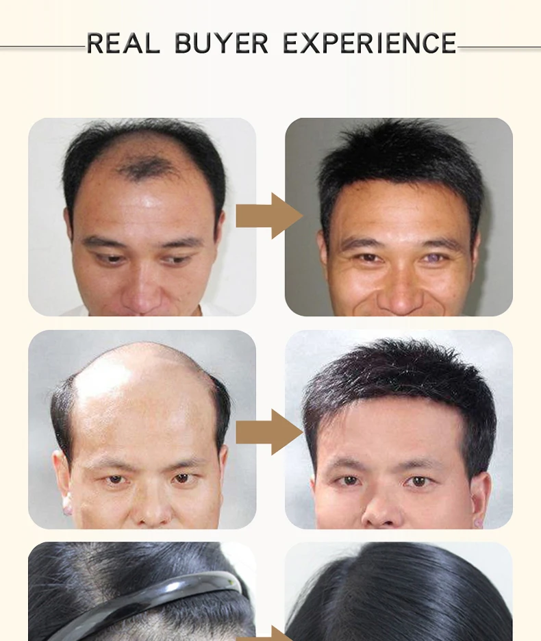 Марокканский травяной женьшень Уход за волосами эссенция лечение мужчин t для мужчин и женщин выпадение волос быстрая мощная Сыворотка для роста волос Восстановление корней волос