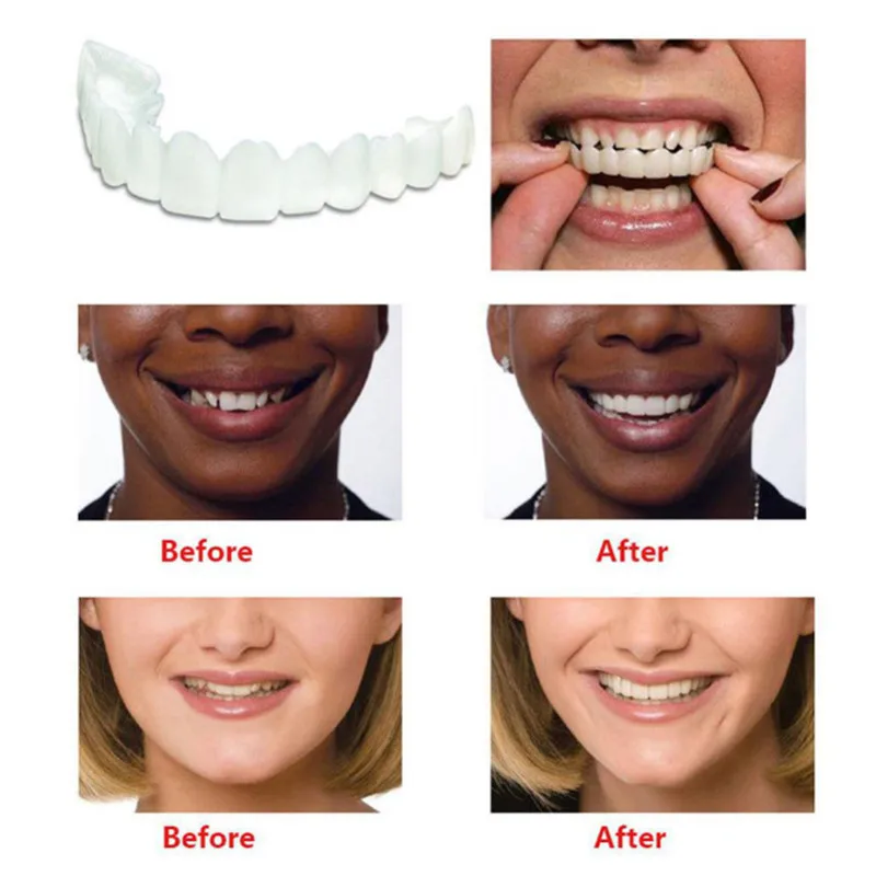 Зубные виниры отбеливающие оснастки на улыбке зубы косметические протезы мгновенная идеальная улыбка зубы поддельная вставная челюсть средства гигиены полости рта