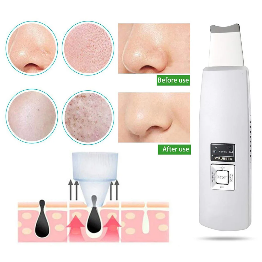 

Portable Ultrasonic Skin Scrubber Face Cleanser Ultrasound Pore Wrinkle Remover Cleaner Face Lifting Skin Care Machine Devices
