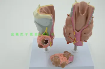 

Thyroid pathology model thyroid armor nail hypothyroidism thyroid disease