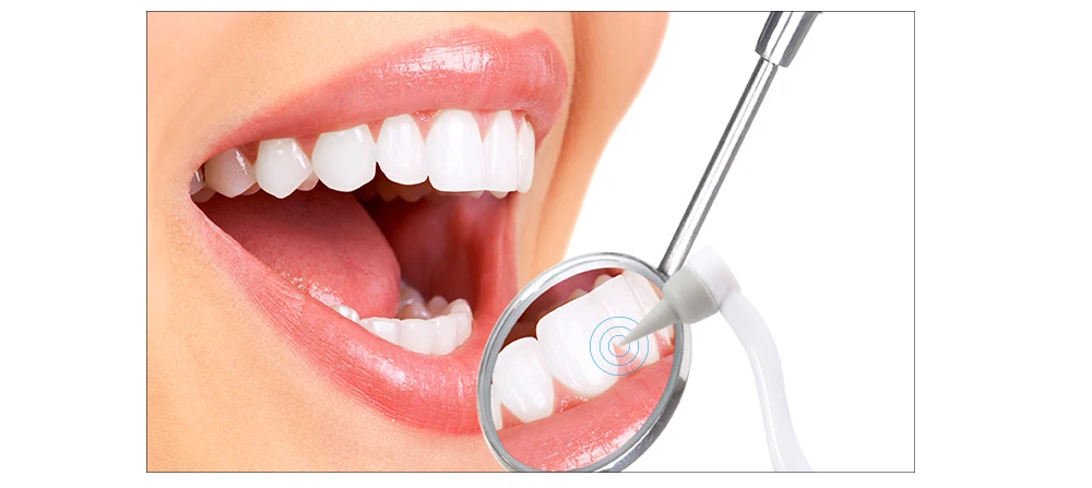 Electric Tooth Stain Eraser Remover Dental Cleaning Teeth Whitening Tool Kit