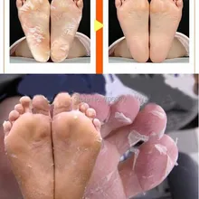 2 пары = 4 шт молочная бамбуковая уксусная удаляет омертвевшую кожу ног гладкое Отшелушивание ног маска для ухода за ногами