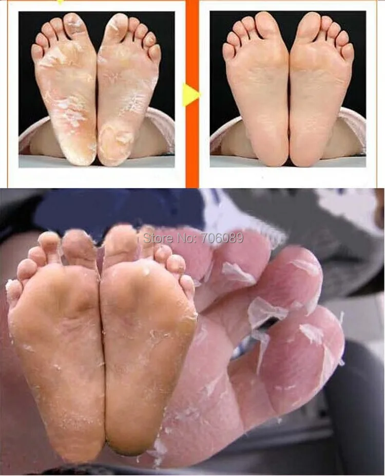

2pairs=4pcs Free shipping Milk bamboo vinegar remove dead skin foot skin smooth exfoliating feet mask foot care