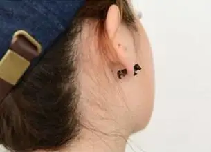 44