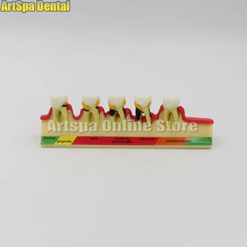 

Dental Teeth Model Periodontal Disease Assort Tooth Classification Model