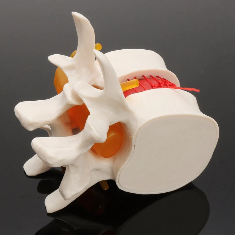 Человеческий анатомический Скелет спина поясница дисковая грыжа обучающая модель мозговой череп травматические школьные принадлежности медицинский инструмент
