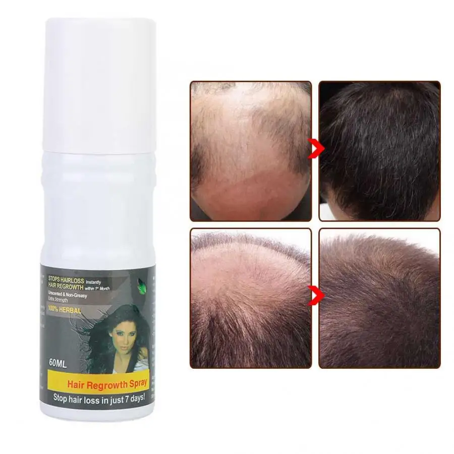

60ml Hair Growth Liquid Hair Loss Treatment Nourishing Hair Regrowth Spray Hair Care Product