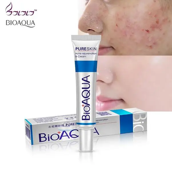 

New face cream whitening skin care anti acne treatment cream oil control Moisturizing Acne Scar Remover Pores bioaqua acne cream