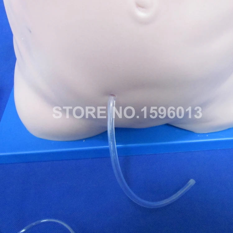 F1 Peritoneal dialysis  (5)