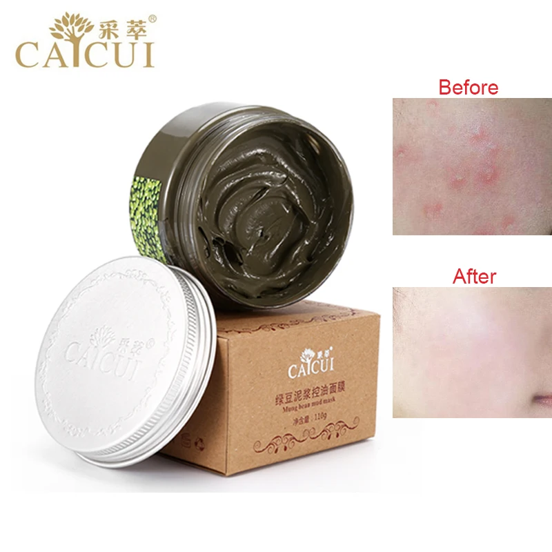 CAICUI Маш Маска Анти Акне Мыть Покраснение Гладкой Кожи Лица Care110g|mud face mask|mask acneblackhead