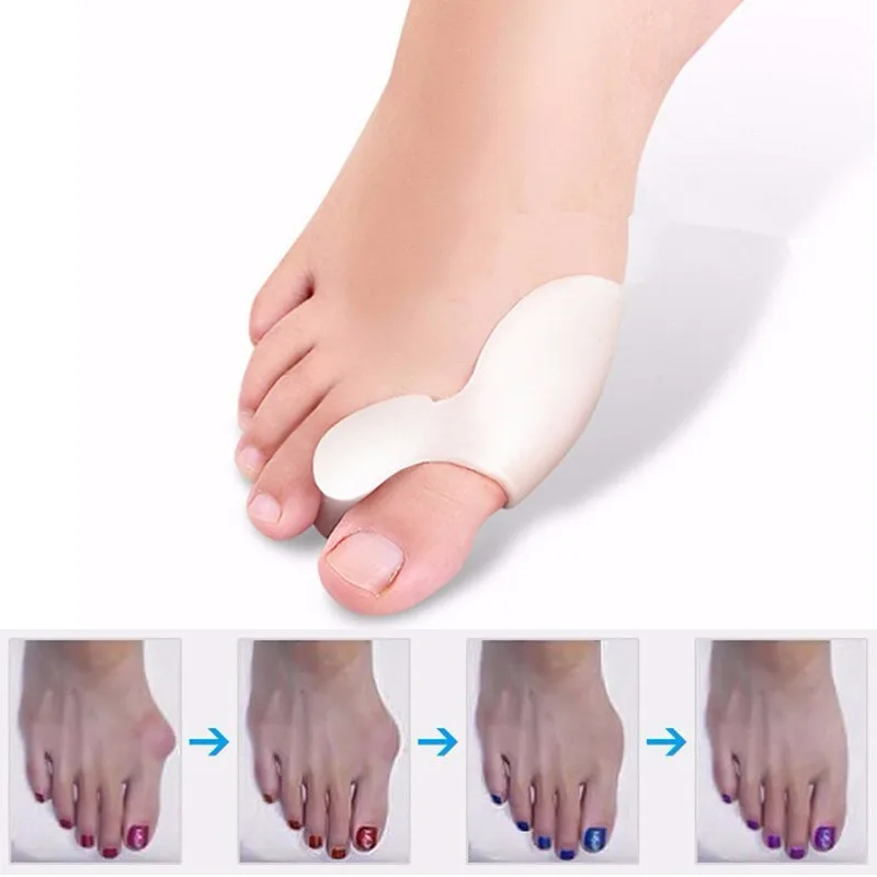 

2pcs=1pair Foot Care Bunion Corrector Hallux Valgus Silicone Toe Separator Orthopedic Pain Relief Straightener Pedicure Tools