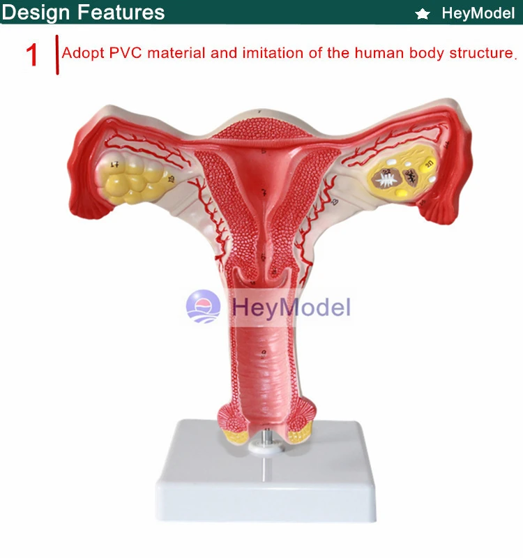 1.PVC_