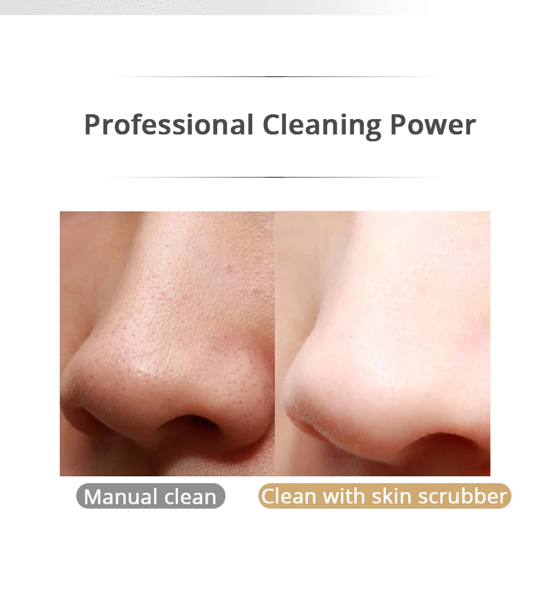 Purificador da Pele Ultra-sônico Nutrição Importor Rosto Poros Limpador Cravo Acne Remoção Esfoliante Máquina Facial Massageador 24 Utensílios de cuidado facial
