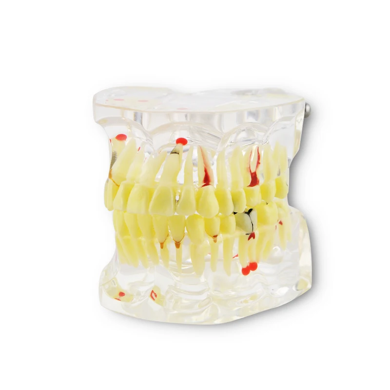 

New Dental Study Tooth Transparent Adult Pathological Teeth Model
