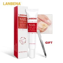 Горячая Распродажа гель для ремонта ногтей Лечение грибков удаление онихомикоза ногти ног Питательный Уход за ногами