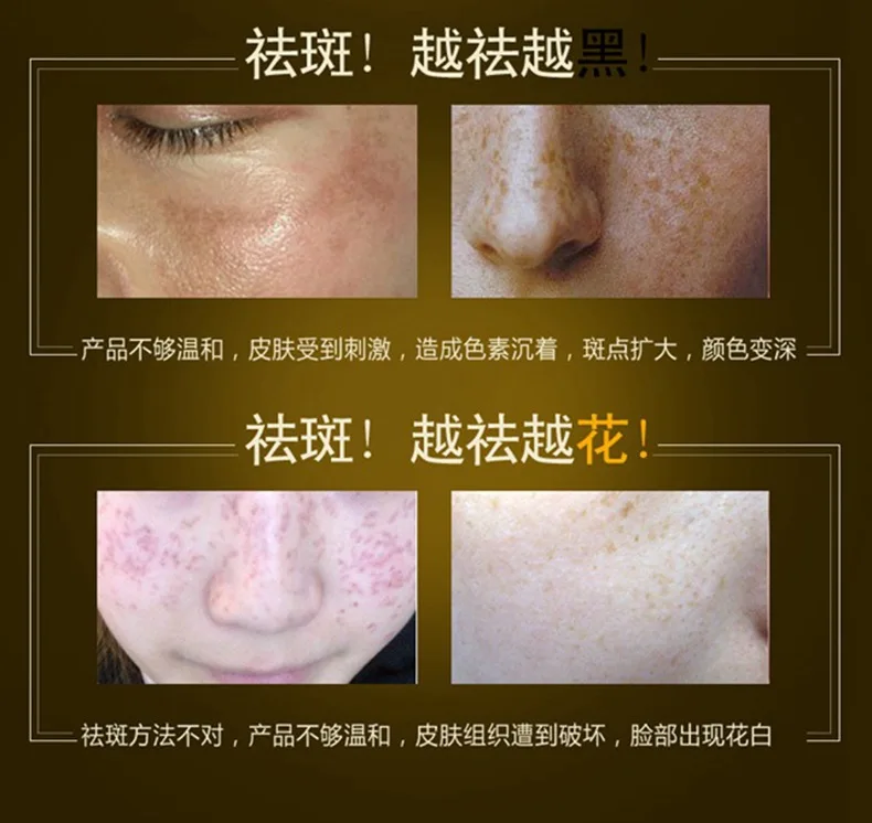 YBL006 face cream 14